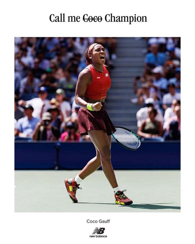 雄鹿的管理 雄鹿的管理